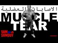 اسباب الاصابات وكيفية علاجها في الرياضة