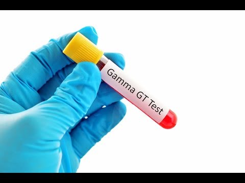 γ-GT = gamma glutamyl-transpeptidase