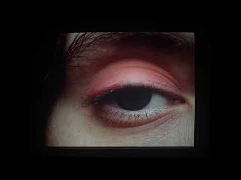 Video 1