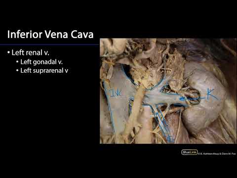 Inferior Vena Cava -  Duodenum, Pancreas and Abdominal Aorta SDV