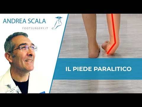 Legamento strappo sulla caviglia Dolore alla scapola mentre ruotando il collo verso sinistra