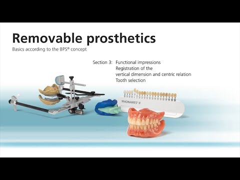 Removable prosthetics workflow 3/7 – Second clinical appointment Video