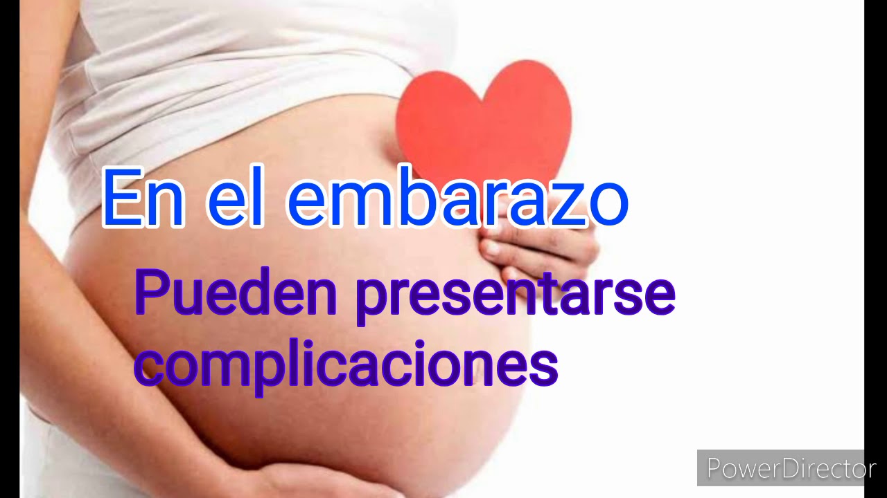 Rafael Gibran Yrigoyen Carranza-7