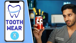 Tooth Wear - My Dental Care App with Dr. Divani