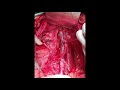 video thumbnail (10)