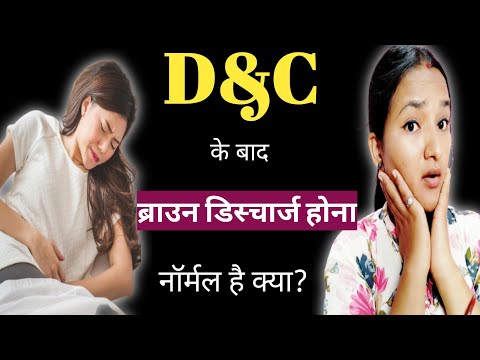 D&C ke baad Brown Discharge hona Normal hai kiya|It is Normal to have a Brownish Discharge After D&C
