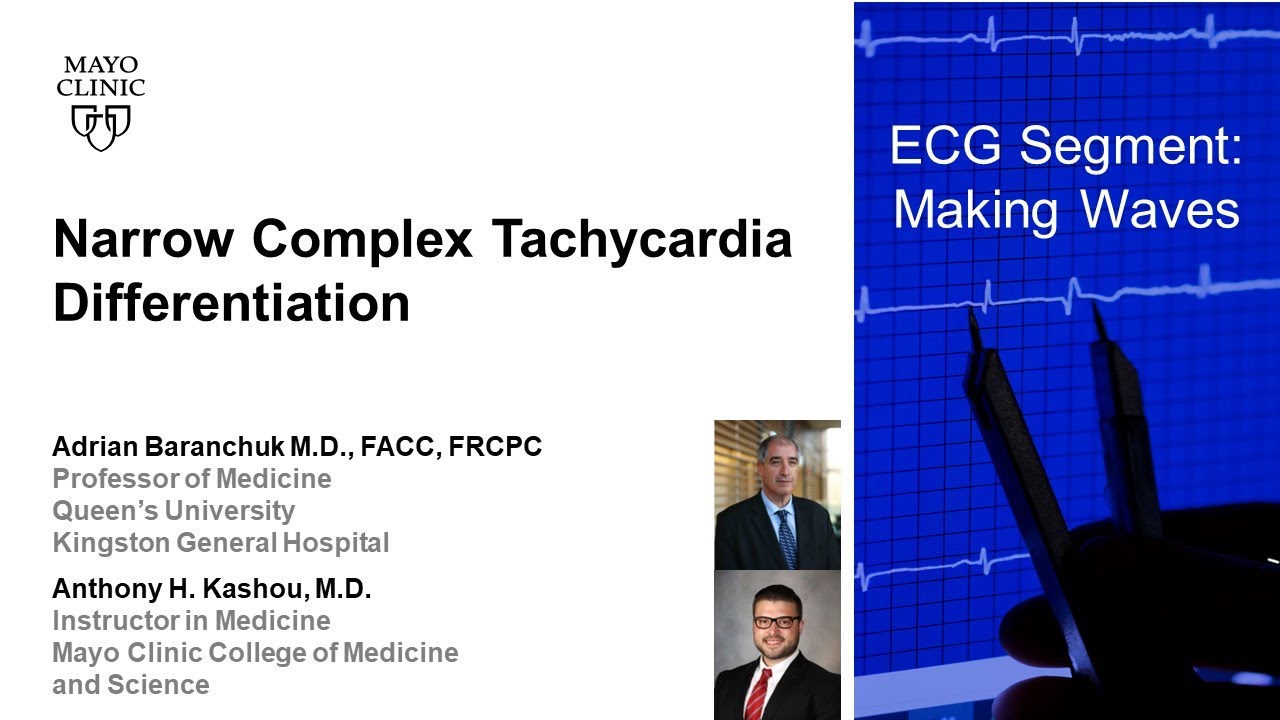 Narrow Complex Tachycardia Differentiation