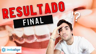 INVISALIGN me cambió la cara 😱  Este es el resultado...