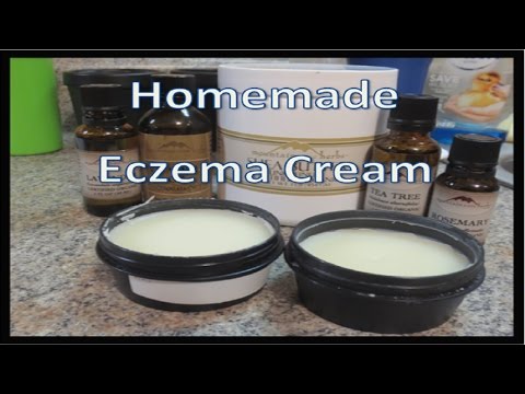 Come togliere il rossore dopo eczema Unguento con zolfo da neurodermatitis