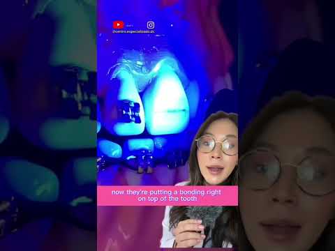 Attaching braces bracket. #braces #brackets #orthodontics #dentist