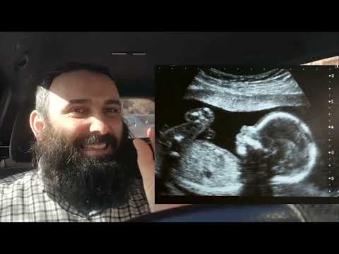 Disa fakte nga mjekësia e të Dërguarit alejhi selam-Ergin SHALA