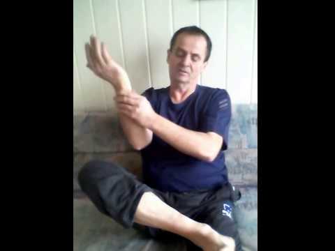 csuklóízület ulnar fájdalma lábujjak artrózisának kezelésére szolgáló módszerek