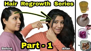 Hair Regrowth Series : Part - 1 Regrow Lost Hair &amp; Receding Hairline खोये हुए बाल वापस उगायें।