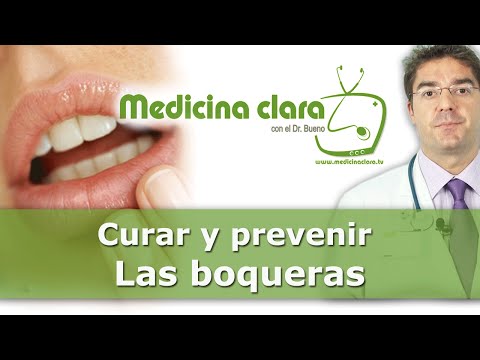 Curar las boqueras, ¿por qué aparecen? ¿Son contagiosas?
