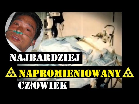 Hisashi Ouchi - Najbardziej napromieniowany człowiek w historii i jego męczarnia. Prawdziwy Horror.