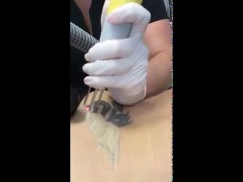 Rethink Laser Gold Coast