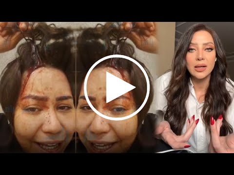 شاهد اول ظهور لـ شيرين عبدالوهاب بعد تعدي حسام حبيب عليها صدمة! ورسالة قاسية من رضوى الشربيني لشيرين