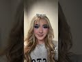 THIS HAPPENED TO MY FACE AFTER 12HRS KAYLAMALECC Shorts