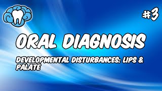 Oral Diagnosis | Developmental Disturbances of the Lips & Palate | INBDE, ADAT