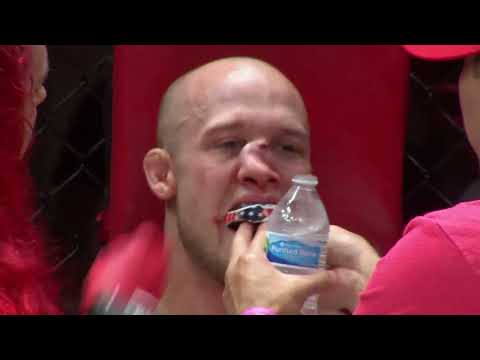 Worse Nose Break in MMA History Blake Perry, Uriah Faber's A1 Combat IV. 7/31/22