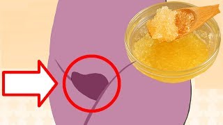 Remove Pubic Hair Permanently | Pubic Hair Removal Home Remedies