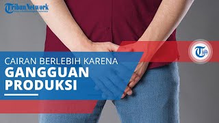 Hidrokel, Penumpukan Cairan di Rongga Lapisan Parietal dan Viseraltunika Vaginalis dari Skrotum