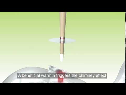 OTOSAN Cono TV Spot 2020-2021 English Subtitles