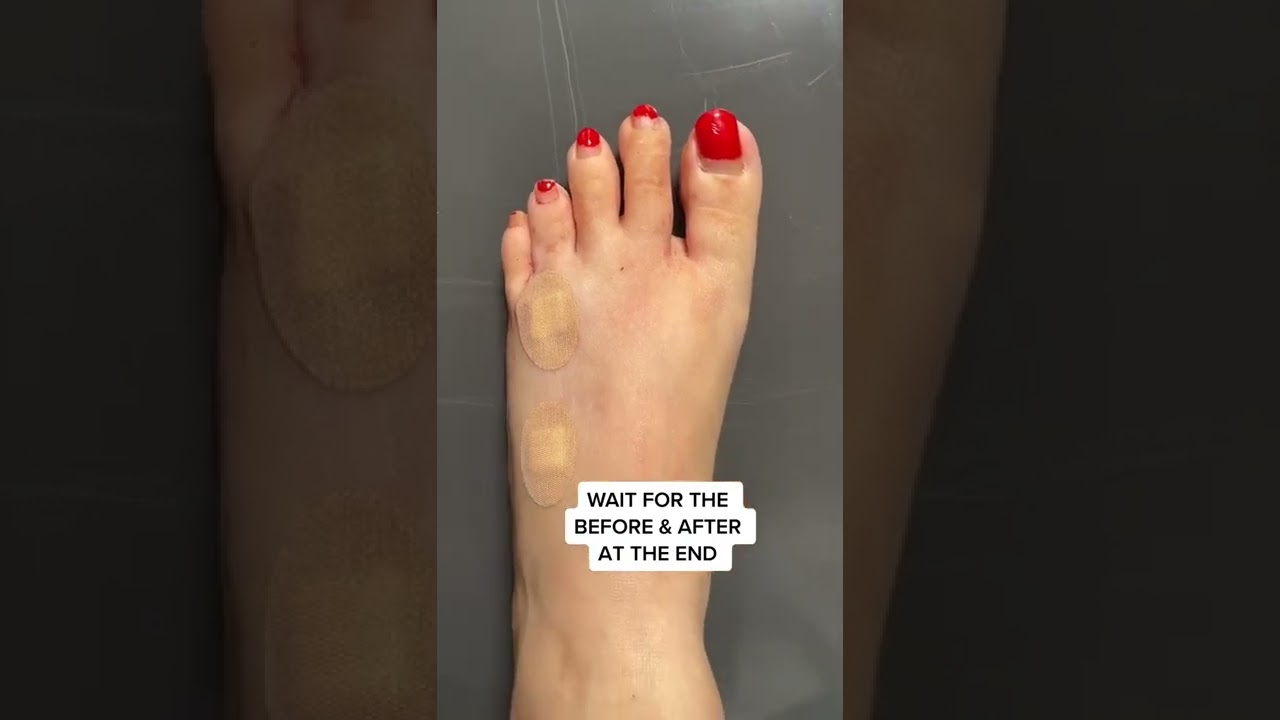 Lengthening Short Toes