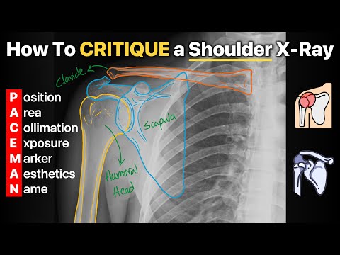 How To Critique a Shoulder X-Ray!