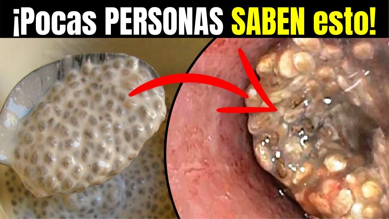Watch 🔥 Los PELIGRO POCO CONOCIDOS de Consumir SEMILLAS DE CHIA ➜ Para que Sirve la Semilla de Chia Now 🔥 Los PELIGRO POCO CONOCIDOS de Consumir SEMILLAS DE CHIA ➜ Para que Sirve la Semilla de Chia