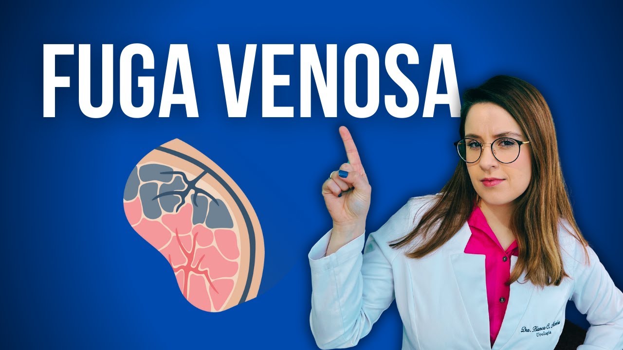FUGA VENOSA: pode ser a causa da sua disfunção erétil