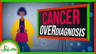 When You Have Cancer, But You're Fine: Cancer Overdiagnosis by  SciShow