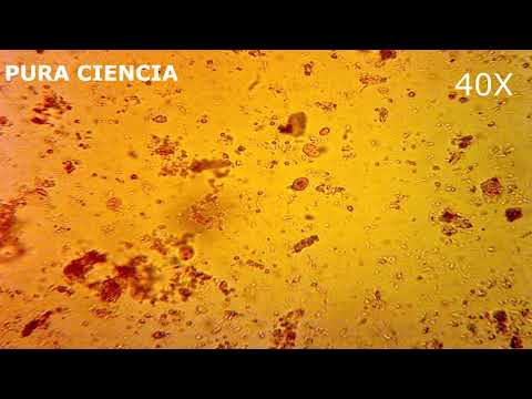 Papilloma virus ceppi oncogeni