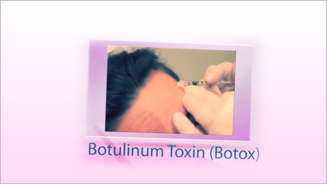 Botox - Allura Skin and Laser Centre