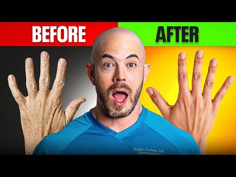 Heal Cracked Fingers FAST: Dermatologist’s Proven Method!