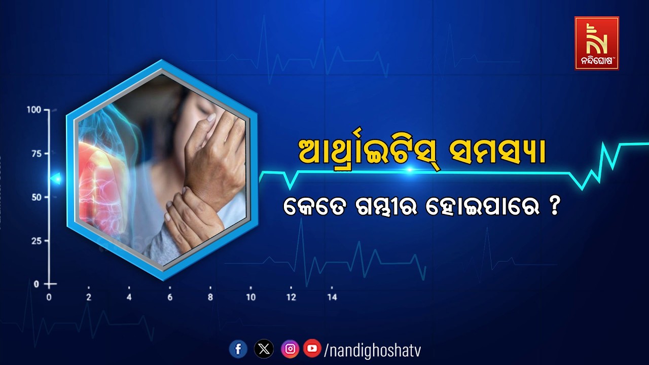 🔴 Live | Healthline | ଆର୍ଥ୍ରାଇଟିସ୍ ସମସ୍ୟା କେତେ ଗମ୍ଭୀର ହୋଇପାରେ ?