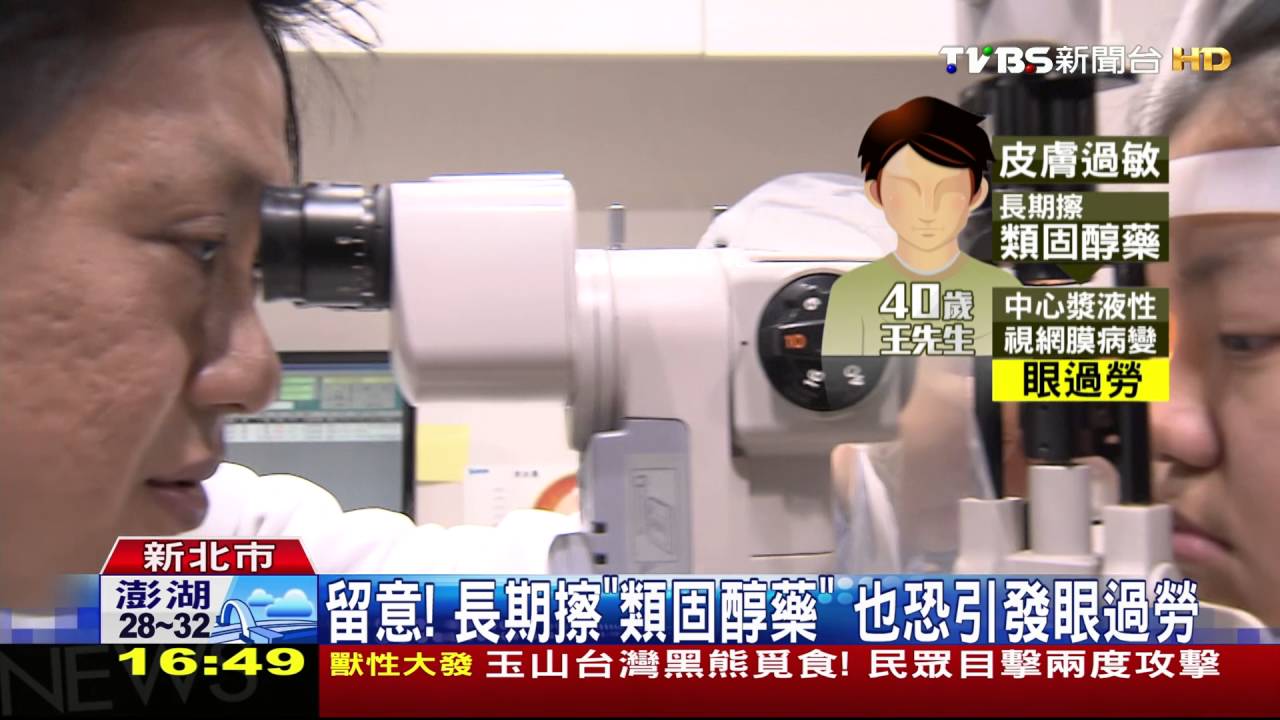 點太多含「類固醇」眼藥水　恐引發「眼過勞」