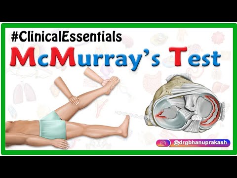 McMurray’s Test for Meniscal Tear Animation: Clinical essentials - Dr G Bhanu Prakash
