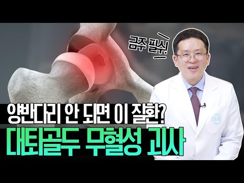 음주력이 있는 사람이라면? 대퇴골두 무혈성 괴사 조심하세요!