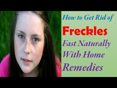 How to Get Rid of Freckles On Face Fast Naturally...