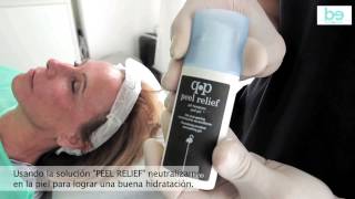 GLYCO PEEL ácido glycolico al 70%