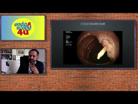 endoscopy4u Kaltschlingenresektion 21 6 22 Vortrag Gerges