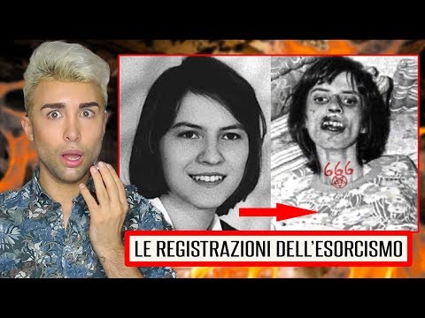 Quale mese appare nella persona di una lentiggine Il tè verde alla panna cinese da pigmentary nota risposte