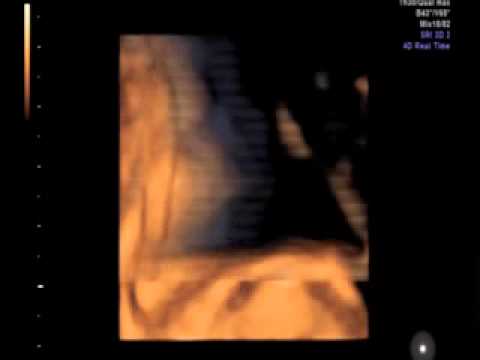 Set video di esercizi per osteocondrosi seno Mal di consulenza collo