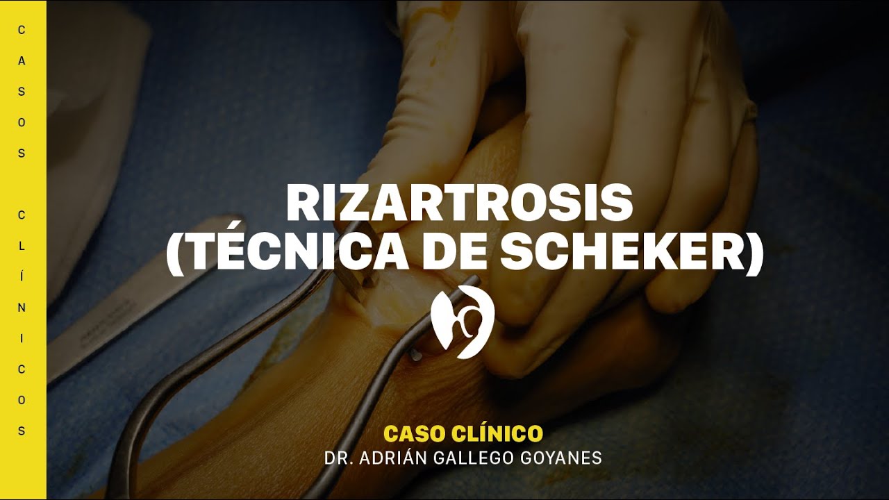 Adrián Gallego Goyanes-33