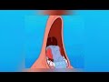 Lovely Sad 1 Hour Version Patrick Photo