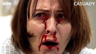 A Training Drill Triggers Real Panic After A Possible Infection Exposure | Learning Curve | Casualty