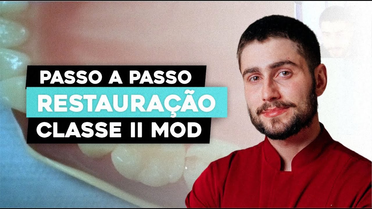 Passo a passo | Restauração Classe II MOD