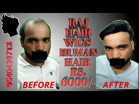 Men Wig - Gents Wig Latest Price, Manufacturers & Suppliers Men Wig - Gents Wig Latest Price, Manufacturers & Suppliers