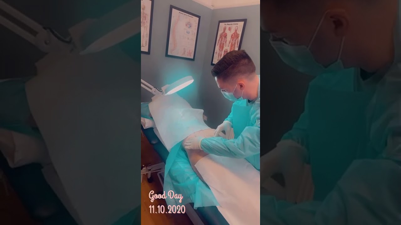 BBL Brazilian Butt Lift Training 3 - Professional Aesthetics Academy